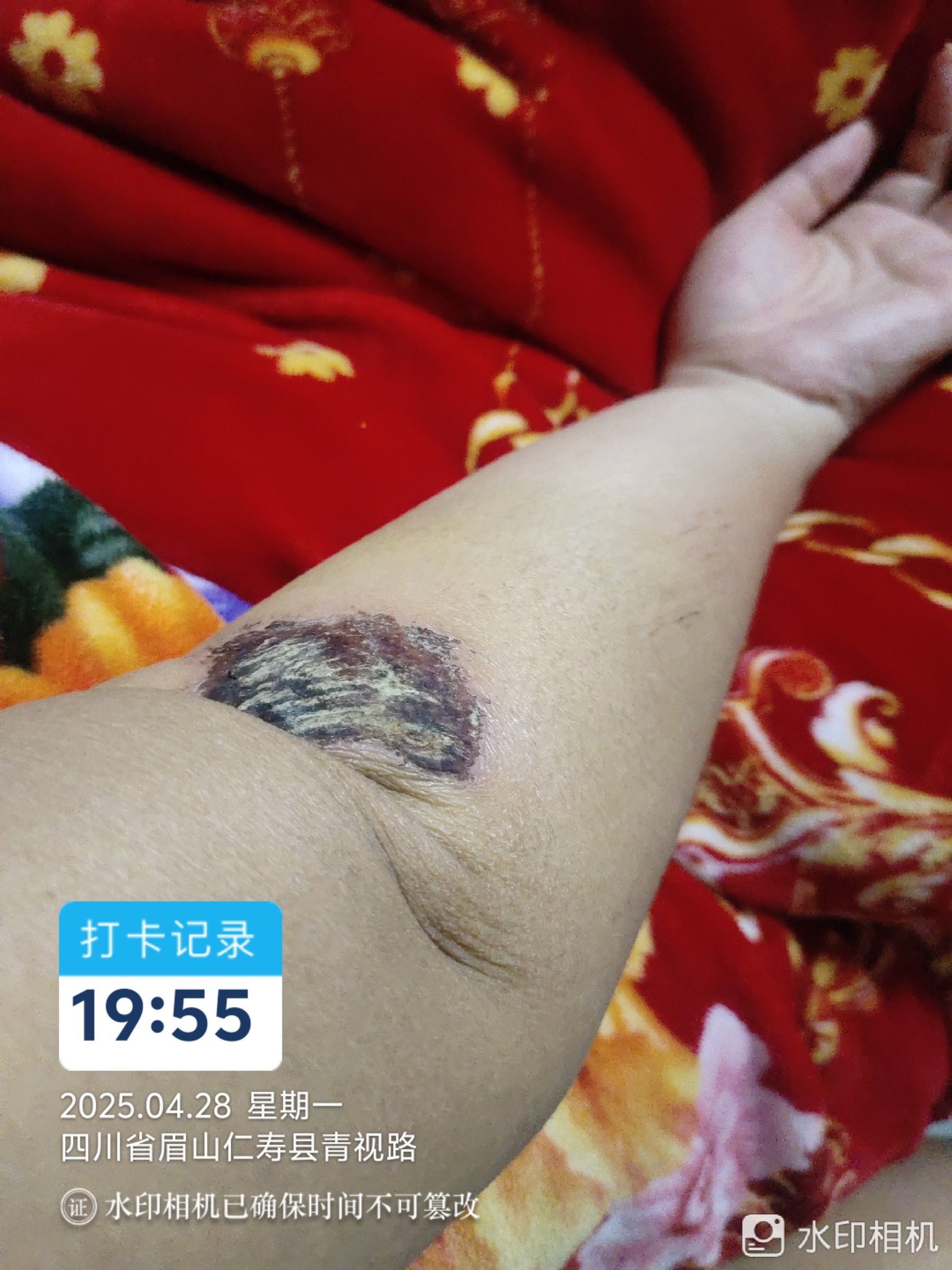 图片附件