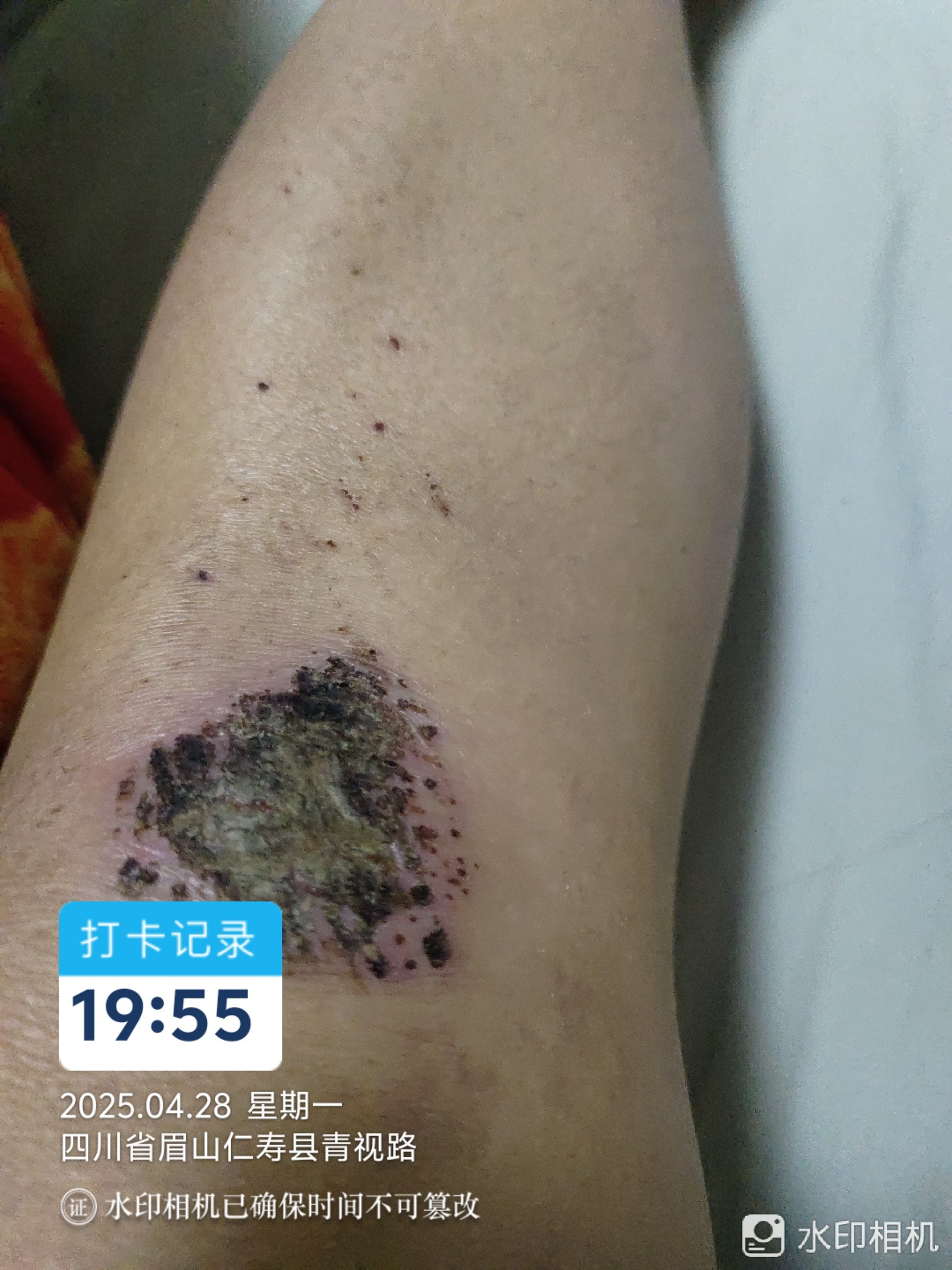 图片附件