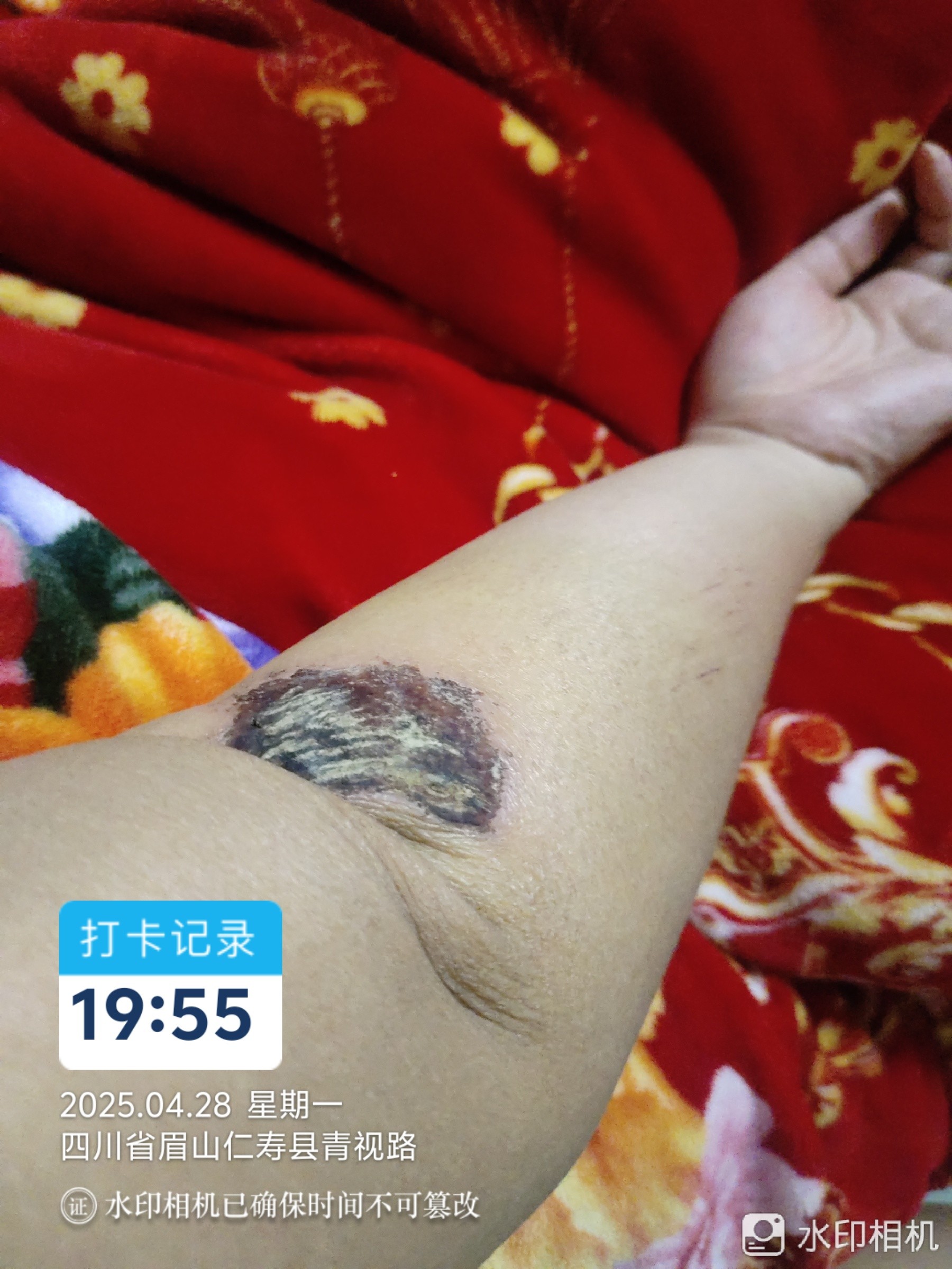 图片附件