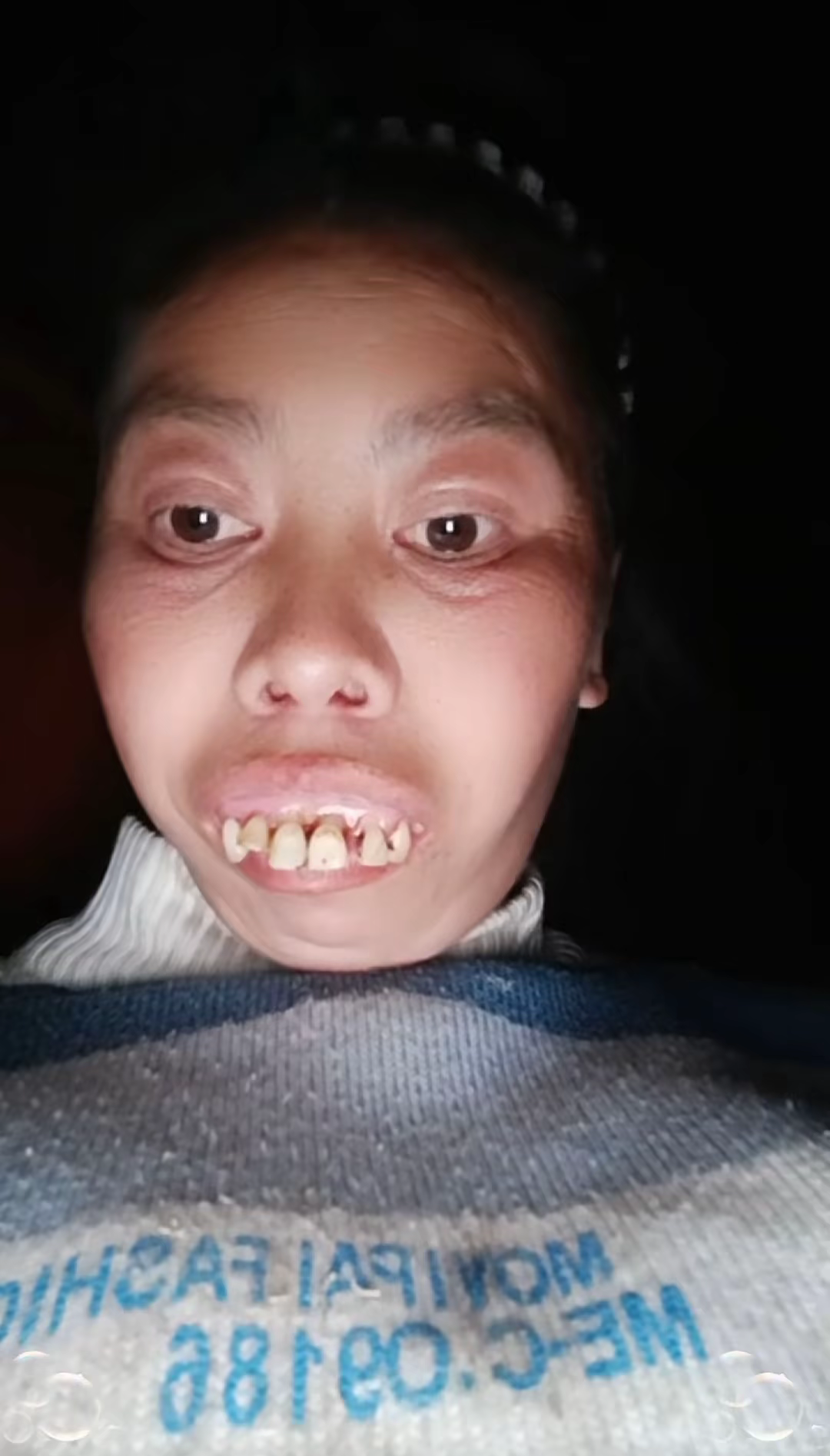 图片附件