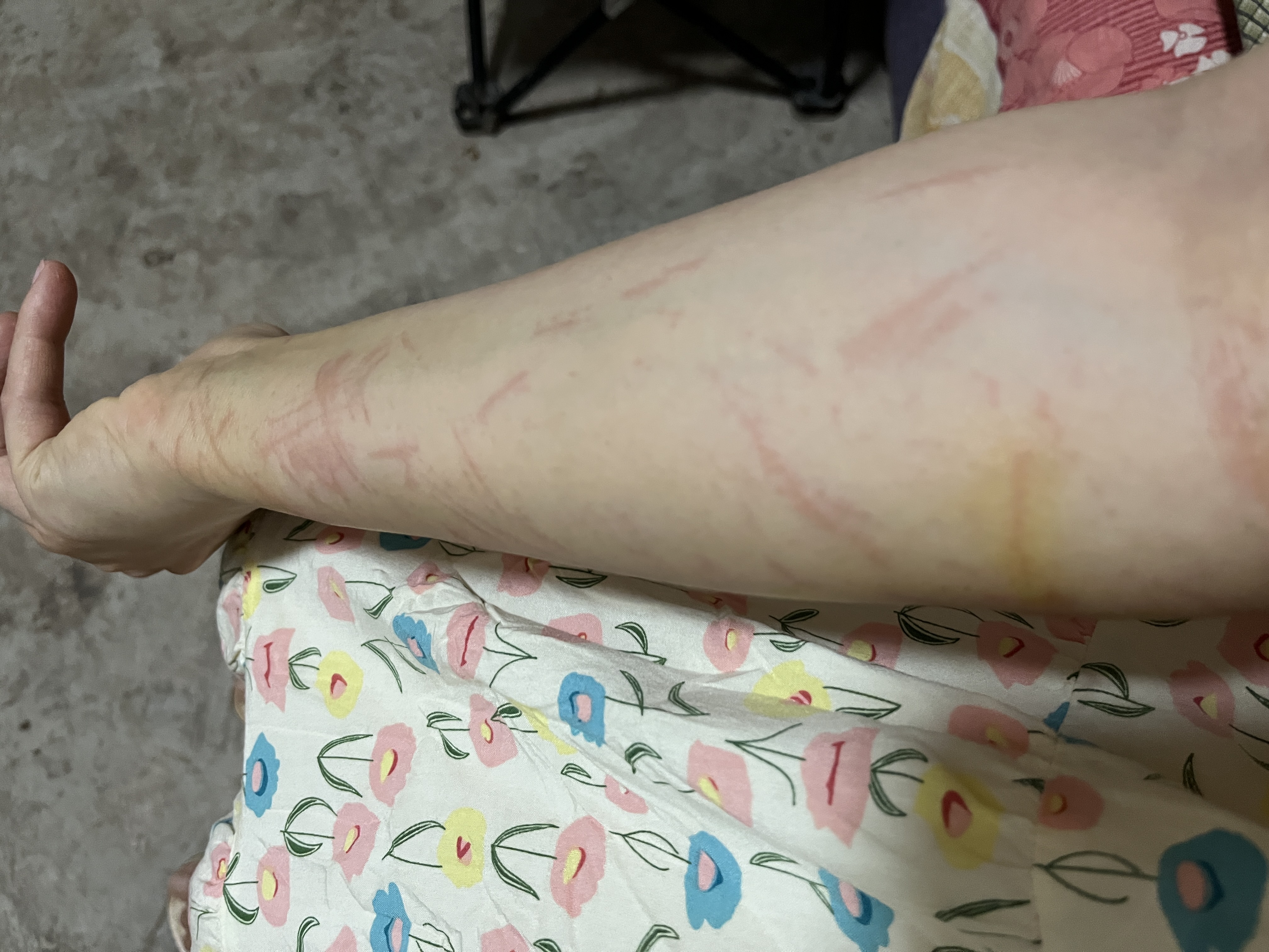 图片附件