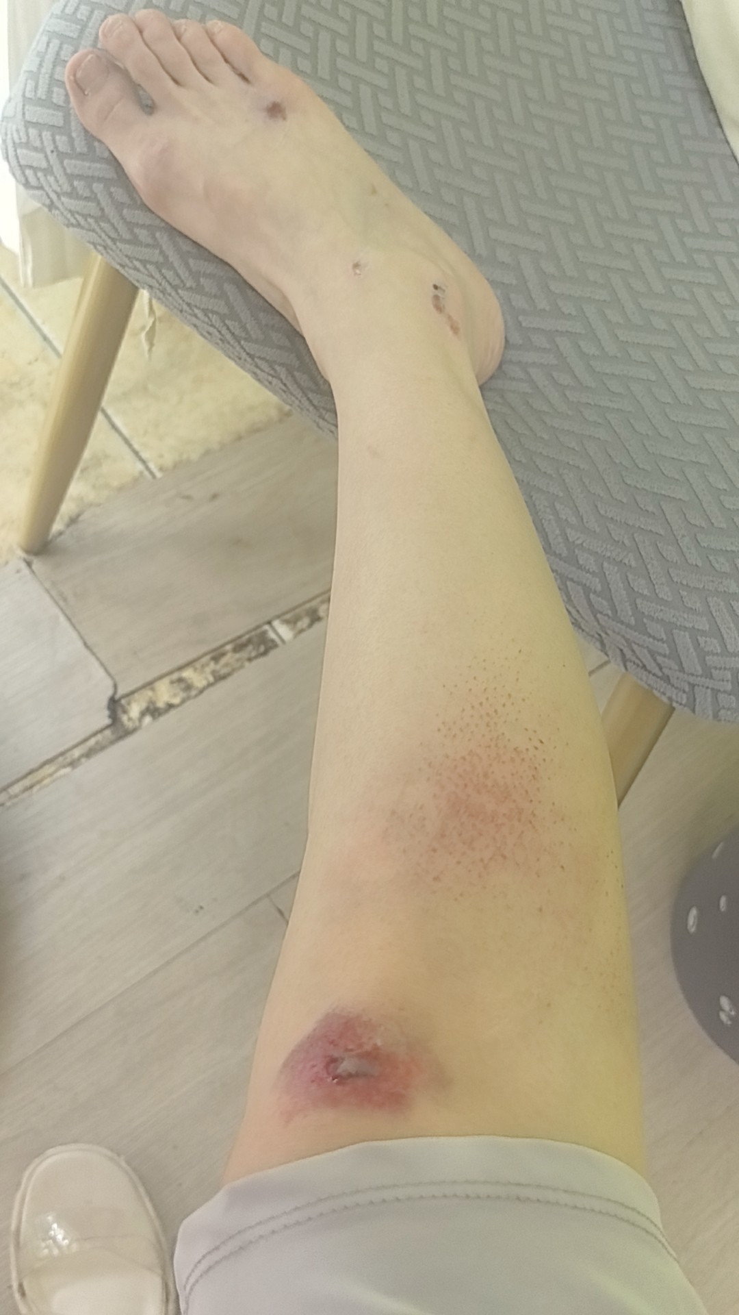 图片附件