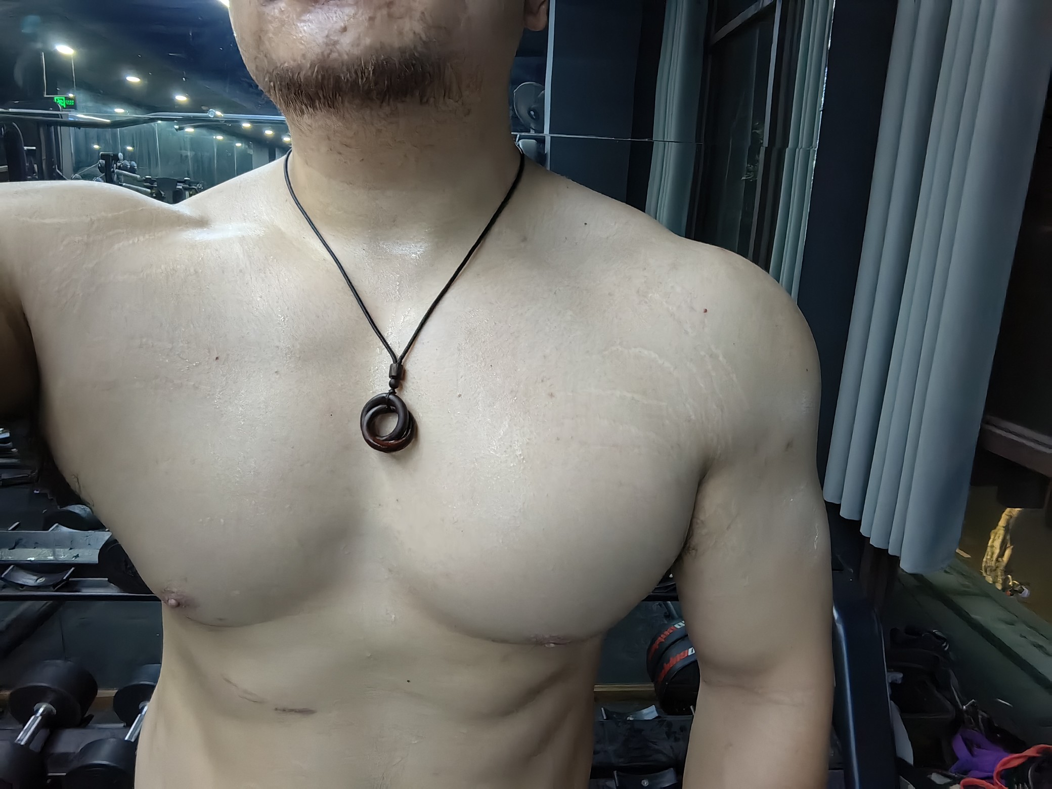 图片附件